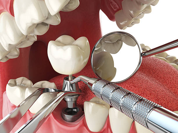 Best Same-Day Emergency Dental Services in Mount Vernon, GA